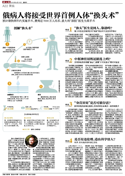 人体换头术最新动态与观点论述速递